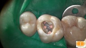 Microscópio Operatório