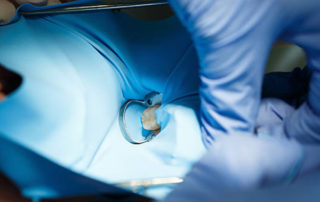 Isolamento do campo operatório