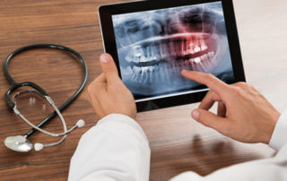 Tecnologias na Endodontia